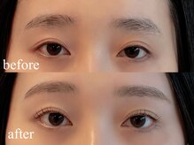 ユーロ(EURO)/ラッシュリフト＆アイブロウ