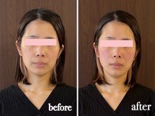 ニコディア(nico-dia)の雰囲気（女性専用/完全個室のあなただけの時間とリラックス空間をご提供）