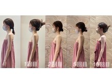 ロココ 豊田店(Rococo)/ビフォーアフター