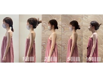 ロココ 豊田店(Rococo)/ビフォーアフター