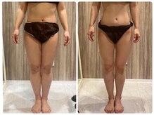 フルリールボーテ(Fleurir Beaut)/筋膜リリースで痩身