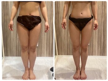 フルリールボーテ(Fleurir Beaut)/筋膜リリースで痩身