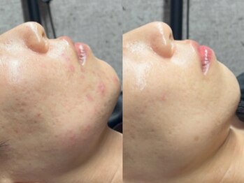 エモーショナル 姫路(Emotional)/最適なメニューをご提案◎