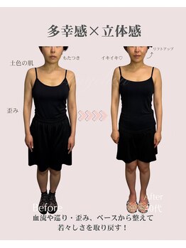 アンジェリカ(Angelica)/体の安定→顔の安定★歪み/姿勢