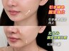 【たるみ激変】埋もれた輪郭を救出! 小顔矯正+極上水光肌ケア ¥３9800→19800