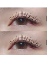 ミニョンヌ(mignonne)/バインドロック