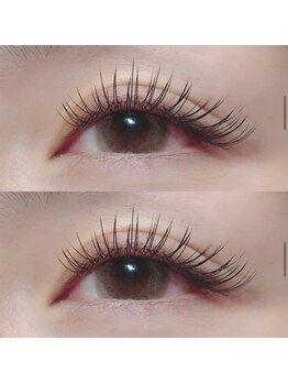 ミニョンヌ(mignonne)/バインドロック