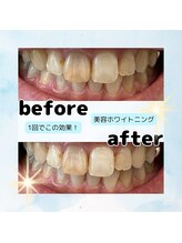 ソレイユ(Soleil)/ビフォーアフター5