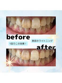 ソレイユ(Soleil)/ビフォーアフター5