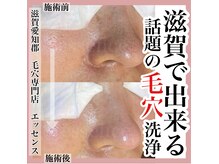 エッセンス(essence)