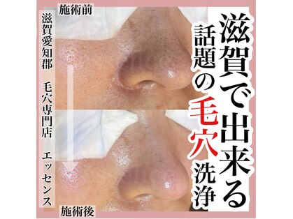 エッセンス(essence)の写真