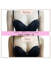 ココロ(COCORO)/バストケア　ビフォーアフター