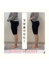 スタイルラボ高松/産後骨盤矯正の効果☆彡