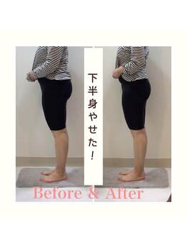 スタイルラボ高松/産後骨盤矯正の効果☆彡