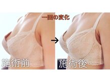 まどかの雰囲気（速攻性のある育乳マッサージは感動！ふっくらバストで笑顔にv）