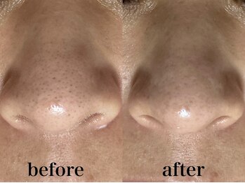 フェイシャルサロン アリイ(ALII)/