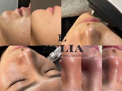 エクリア(ECLIA)の写真