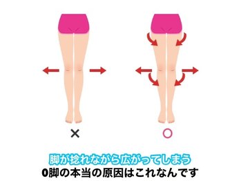 タスク整体院 静岡安倍川店/O脚の本当の原因