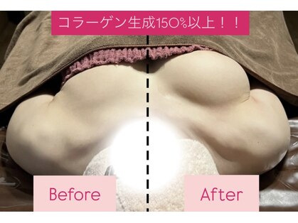 リノレア(LinoLea)の写真