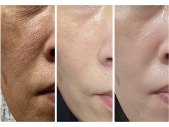 サロン ルポ(salon Repo)/