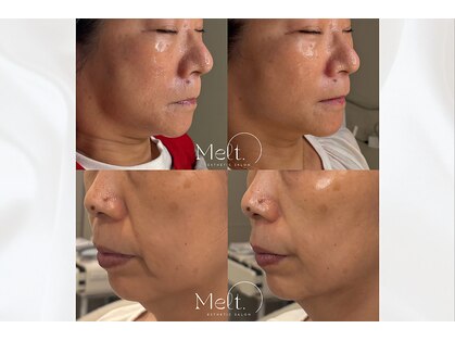 メルト 中目黒(Melt.)の写真