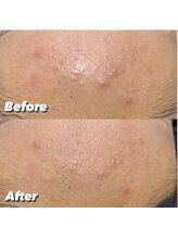 ディメンション 大里店(DIMENSION)/モデリングパック