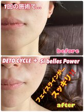 ルミネ(Lumine)/フェイスラインの気になる方に！