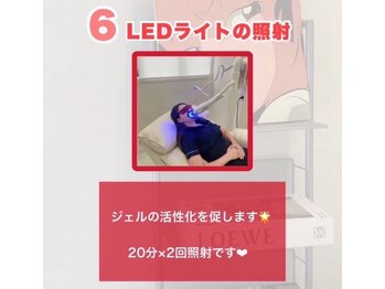 ホワイトニングショップ 吉祥寺店/施術の流れ