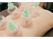 今注目の【カッピング】施術メニューあります◎