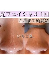 アースコアフュールボーテ ひたち野うしく店(EARTH coiffure beaute)/光フェイシャル