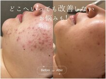 サロンドシー(SALON DE C)/大人気の定額プランの魅力