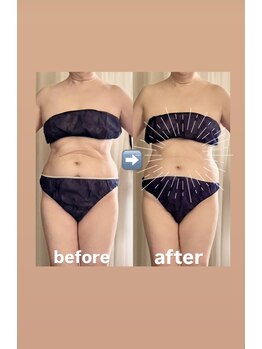 サロン ド プリヴェ(Salon de PRIVE)/60代☆トリートメント12回