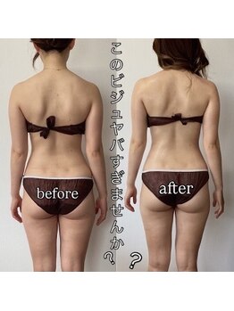 エヌボーテ(N. beaute)/全身痩身コース#6回目