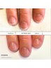 3ヶ月で縦長のお爪になりたい方《自爪育成ケア》体験カウンセリング