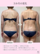 プラスワンビューティテン 新大阪店(Plus One Beauty)/ボディ/ハイパーナイフ/痩身