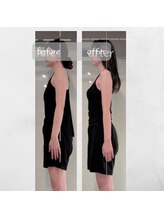 ユーニマルヨン(ewe204)/4月→8月にかけての変化に感動