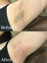 ジョエルワックス 沖縄那覇店(JOELLE WAX)/ワキの自己処理の負担軽減！！