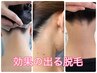 【襟足&うなじ脱毛】卒業式に向けて脱毛始める良いタイミングです！3名限定