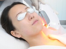 ヴェヴェ(VeVe)/施術開始