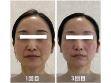 アクアンジュ(Aquange)/いつまでも綺麗なママでいたい