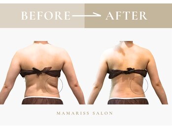 ママリスサロン(Mamariss Salon)/【骨盤矯正 1回の変化】