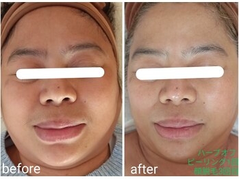 エム(M)/整体 小顔矯正 顔脱毛