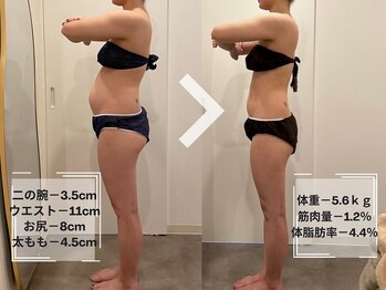 ミルズ 天神店(MillS)/ダイエットビフォーアフター