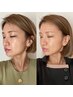 【別人級★初回】テラボーラー×テラパック¥19,800 → ¥9,800