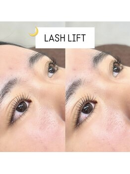 バニーアイズ 博多店(Bunny eyes)/LASH LIFT