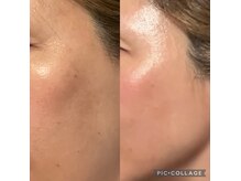 キレイになる路の雰囲気（難しい肝ぱんもキレイにたるみエイジングにも）