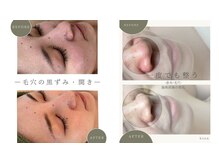 ビオン 松戸(bion)