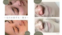 ビオン 松戸(bion)