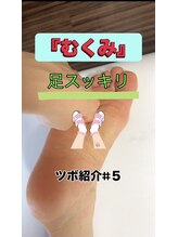 経絡鍼灸院 野村/『足のむくみ』がある人はここ！