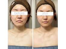 パル コルギサロン(Pal. Korugi salon)/コルギビフォーアフター